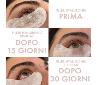 Filler Hyaluronic - Siero Vegano per Ciglia e Sopracciglia KALENTIN - 10ml kalentin