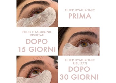 Filler Hyaluronic - Siero Vegano per Ciglia e Sopracciglia KALENTIN - 10ml kalentin